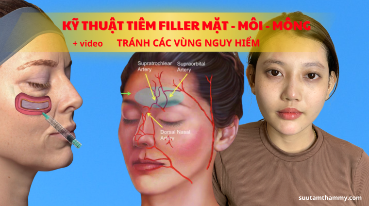 CĂNG CHỈ NÂNG CAO-11 CĂNG CHỈ NÂNG CAO-11