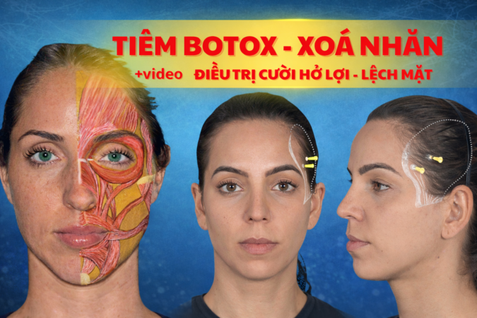 b botox
