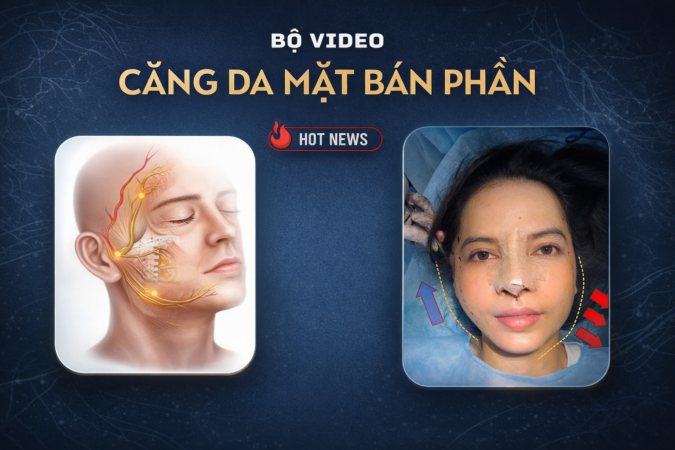 b căng da bán phần