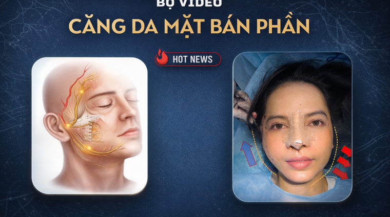 b căng da bán phần