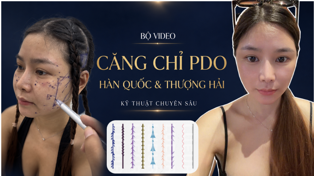 KỸ THUẬT CĂNG CHỈ PDO NÂNG CAO THƯỢNG HẢI & HÀN QUỐC